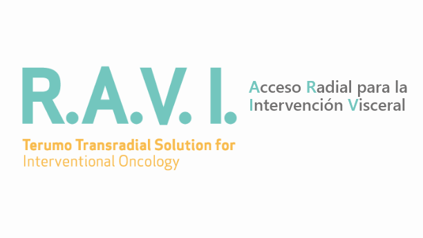 Nueva página para el lanzamiento R.A.V.I.